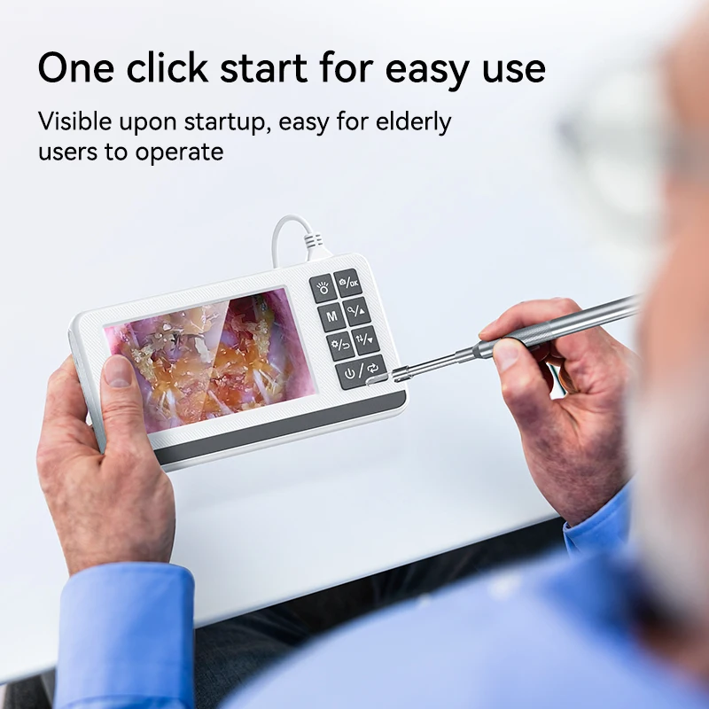 Kanoscope, otoscope numérique