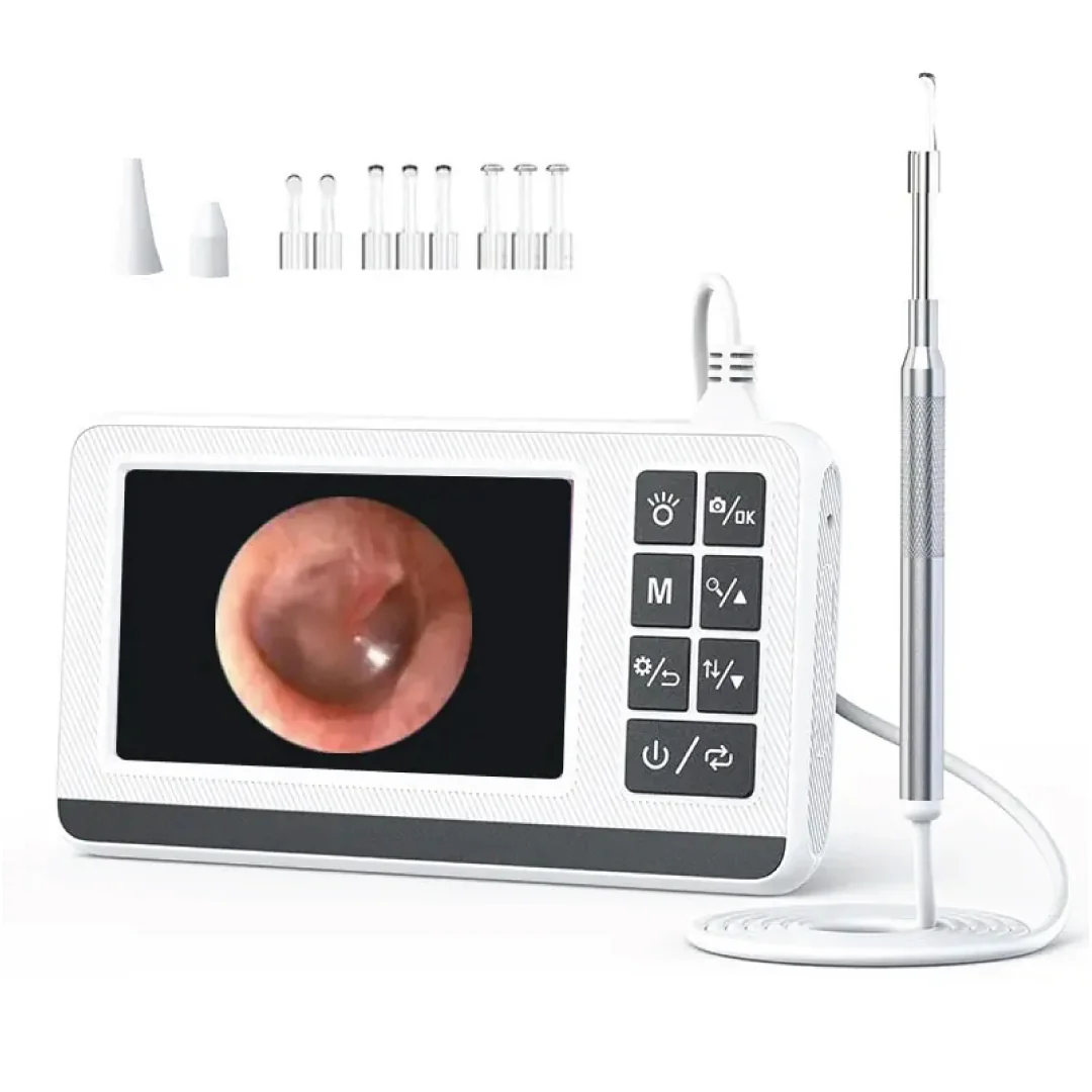 Kanoscope, otoscope numérique