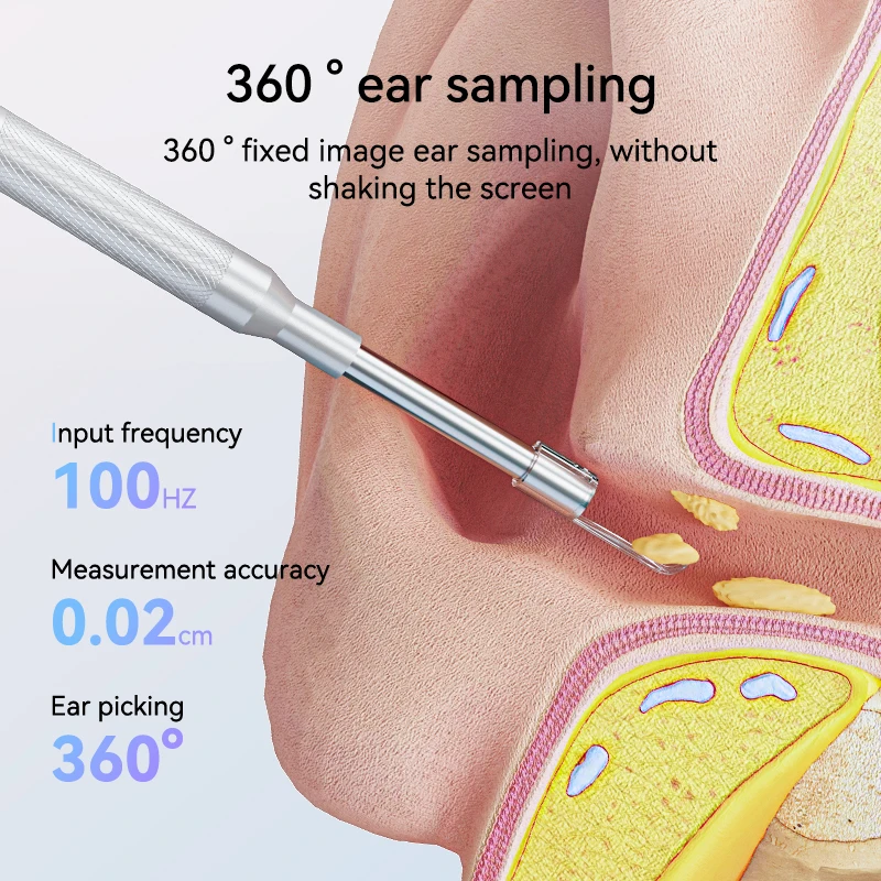 Kanoscope, otoscope numérique