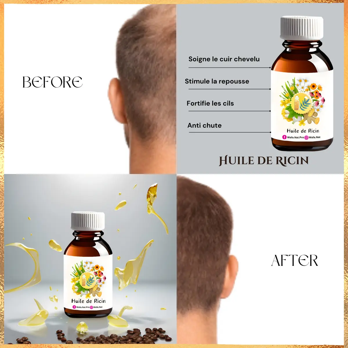 Huile de Ricin Extra Vierge – Soin Naturel et Multi-Usage