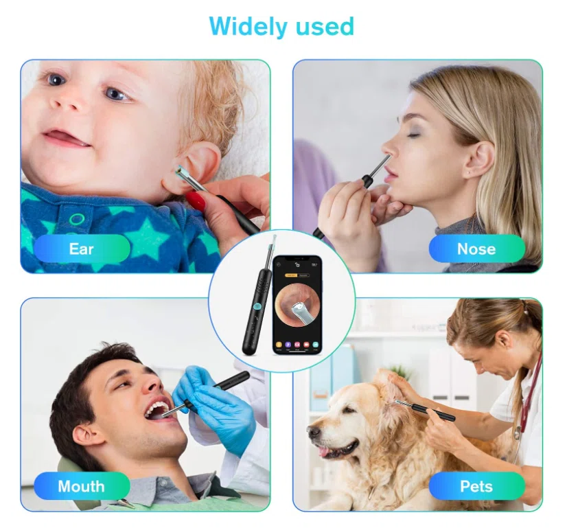 Micro-Caméra Otoscope Sans Fil 1080P,Kit de Nettoyage d'Oreille Compatible iPhone, iPad et Android