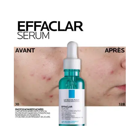 la roche posay effaclar serum ultra concentre