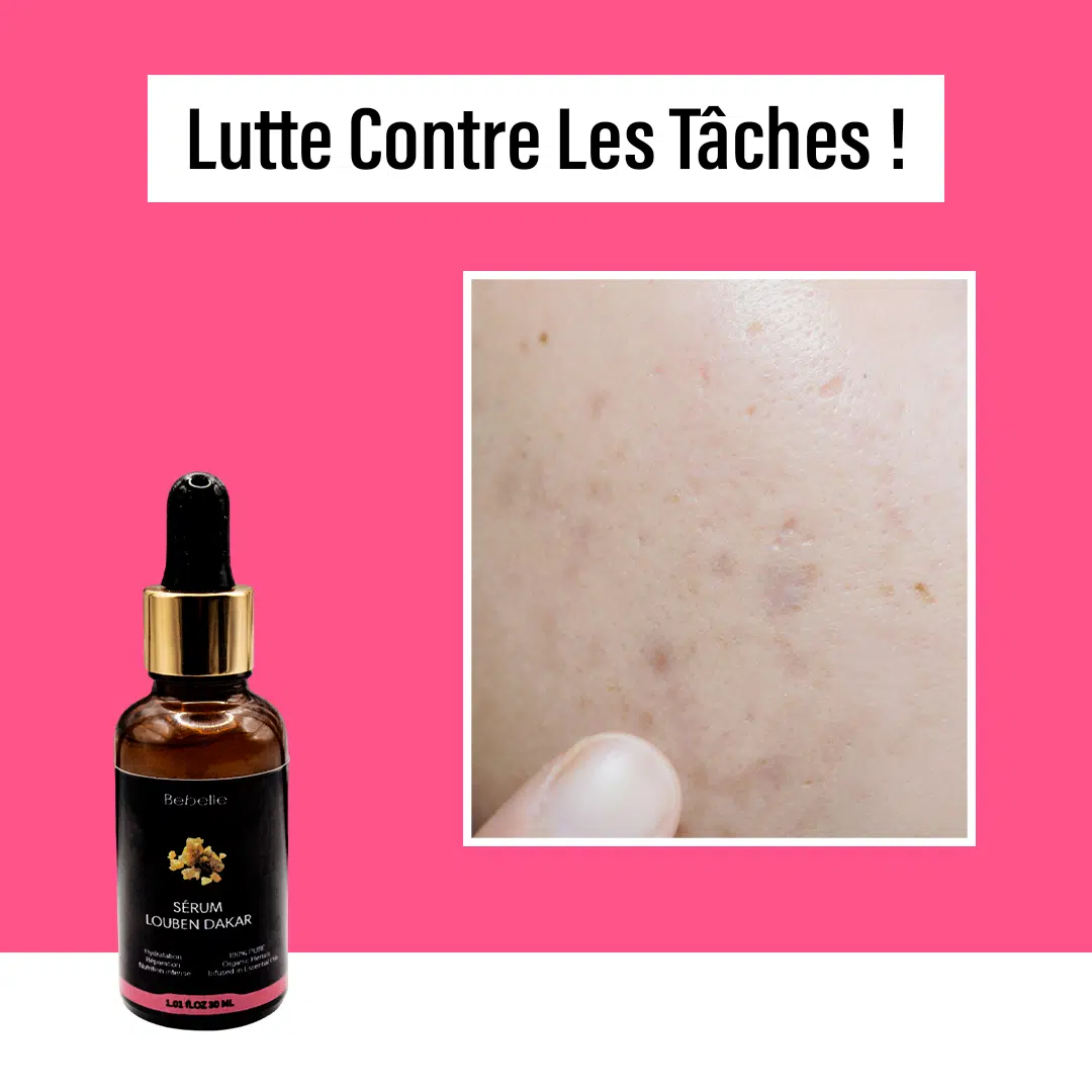 Bebelle™ Sérum au Louben Dakar